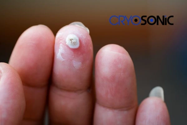 Learn more about us Rugby at Cryosonic. Book in today! Rugby