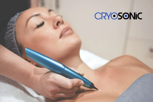 Cryosonic lesion removal prices book today! Rugby