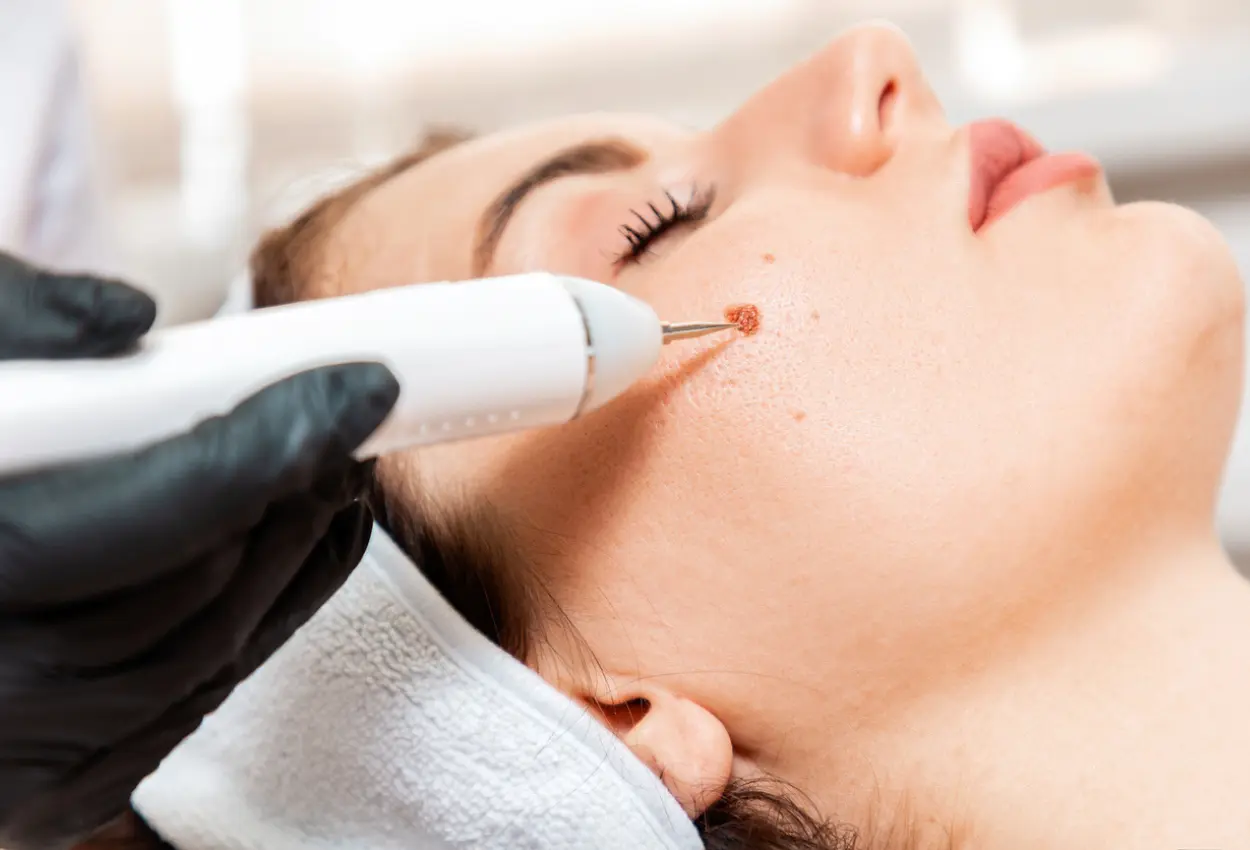 Frequently Asked Questions About Multiple Cryotherapy Treatments Rugby